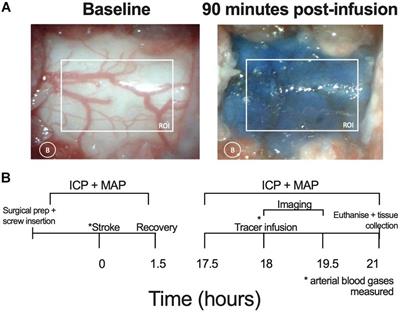 Altered Cerebrospinal Fluid Clearance and Increased Intracranial Pressure in Rats 18 h After Experimental Cortical Ischaemia